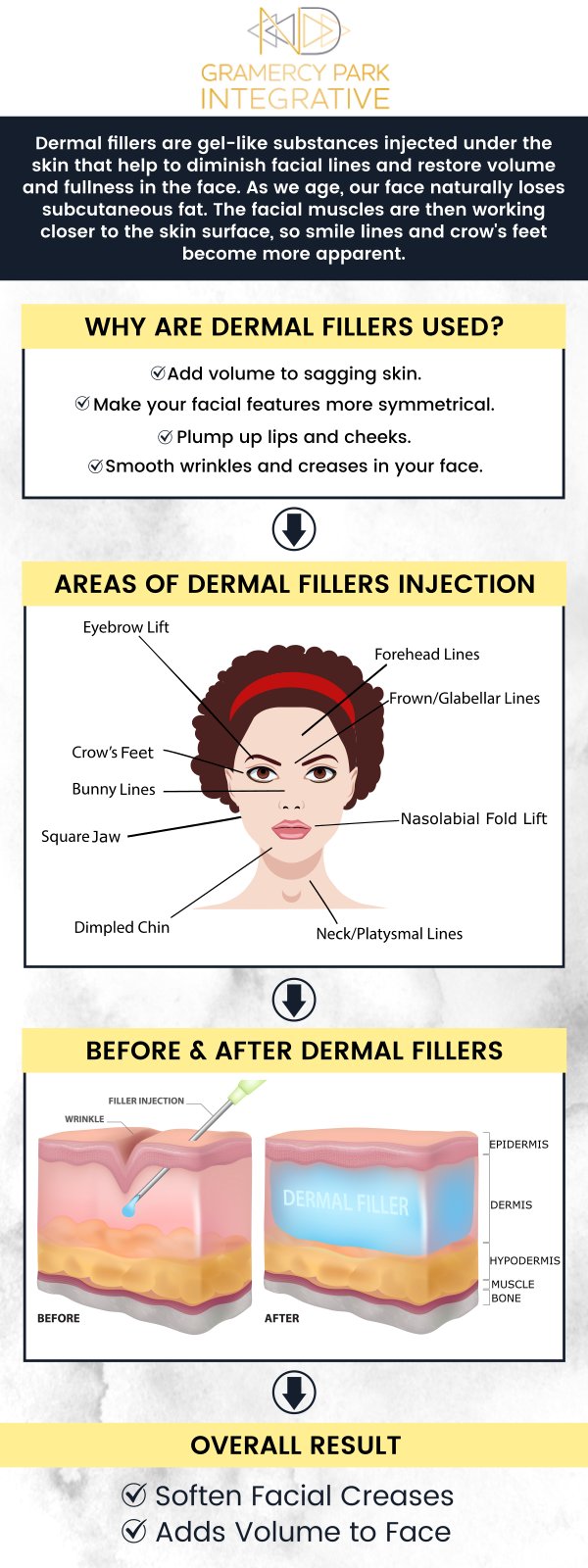Common questions asked by clients: What is a dermal filler? How long do dermal fillers last? What is the difference between Botox and dermal fillers? Who should not get fillers? For more information, please contact us or request an appointment online. We are conveniently located at 7 Lexington Avenue Suite 1A New York, NY 10010. We serve clients from New York NY, Manhattan NY, Brooklyn NY, Harlem NY, Queens NY, Yonkers NY, and surrounding areas. Common questions asked by clients: What is a dermal filler? How long do dermal fillers last? What is the difference between Botox and dermal fillers? Who should not get fillers? For more information, please contact us or request an appointment online. We are conveniently located at 7 Lexington Avenue Suite 1A New York, NY 10010. We serve clients from New York NY, Manhattan NY, Brooklyn NY, Harlem NY, Queens NY, Yonkers NY, and surrounding areas.
